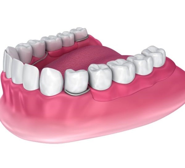 Dental Dentures Lexington KY 40506